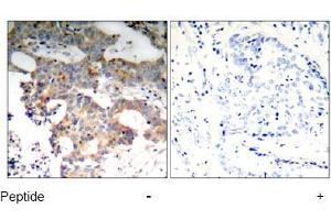 Image no. 1 for anti-Nuclear Factor of kappa Light Polypeptide Gene Enhancer in B-Cells Inhibitor, epsilon (NFKBIE) (Ser22) antibody (ABIN197570) (NFKBIE antibody  (Ser22))