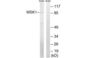 Western blot analysis of extracts from mouse brain cells, using MSK1 (epitope around residue 212) antibody.