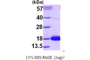 SDS-PAGE (SDS) image for Cytidine Deaminase (CDA) (AA 1-146) protein (His tag) (ABIN667230)