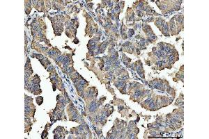 IHC analysis of ARL13B using anti-ARL13B antibody (ABIN7600179). (ARL13B antibody  (AA 16-428))