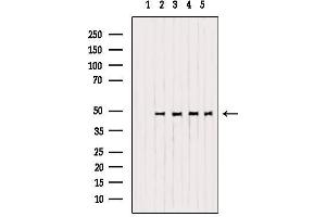 Western blot analysis of extracts from various samples, using OPRM1 Antibody.