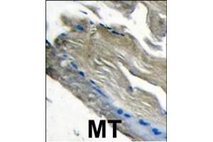 Formalin-fixed and paraffin-embedded human muscle tissue tissue reacted with PI3CKG antibody (C-term) (ABIN392816 and ABIN2842247) , which was peroxidase-conjugated to the secondary antibody, followed by DAB staining. (PIK3 gamma antibody  (C-Term))