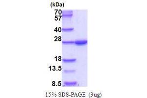 SDS-PAGE (SDS) image for BCL2/adenovirus E1B 19kDa Interacting Protein 1 (BNIP1) (AA 1-199) protein (His tag) (ABIN5854009) (BNIP1 Protein (AA 1-199) (His tag))
