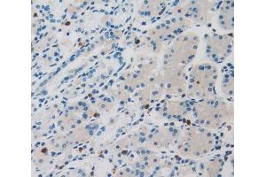 Used in DAB staining on fromalin fixed paraffin- embedded stomach tissue (LOR antibody  (AA 210-295))