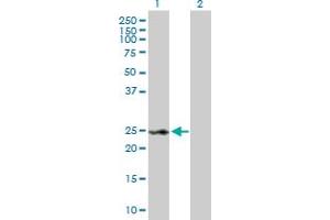 Western Blot analysis of RAD54B expression in transfected 293T cell line by RAD54B MaxPab polyclonal antibody. (RAD54B antibody  (AA 1-158))