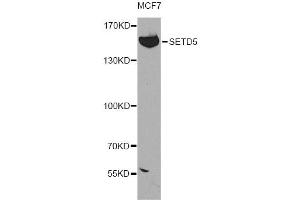 Western blot analysis of extracts of MCF-7 cells, using SETD5 antibody (ABIN5974406) at 1:300 dilution. (SETD5 antibody)