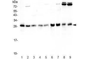 Western blot testing of human 1) HeLa, 2) Jurkat, 3) MCF7, 4) HepG2, 5) A549, 6) rat stomach, 7) rat thymus, 8) mouse thymus and 9) mouse NIH3T3 lysate with RAB27A antibody at 0. (RAB27A antibody)