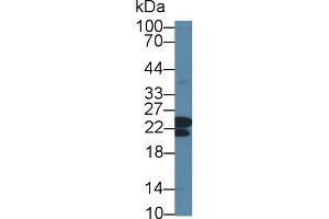 Western Blotting (WB) image for anti-Core-Binding Factor, beta Subunit (CBFB) (AA 1-187) antibody (ABIN7444325)