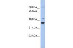Image no. 1 for anti-Glutamate Decarboxylase-Like 1 (GADL1) (AA 215-264) antibody (ABIN6743948) (GADL1 antibody  (AA 215-264))