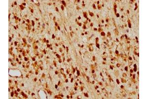 Immunohistochemistry (IHC) image for anti-Cyclin-Dependent Kinase Inhibitor 1B (p27, Kip1) (CDKN1B) antibody (ABIN7127421)