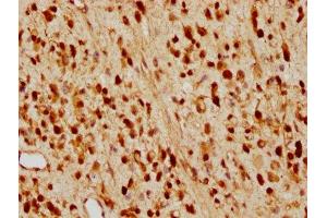 IHC image of ABIN7127421 diluted at 1:97. (Recombinant CDKN1B antibody)