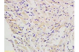 Formalin-fixed and paraffin embedded rat heart labeled with Anti-FLIP Polyclonal Antibody, Unconjugated  at 1:200 followed by conjugation to the secondary antibody and DAB staining. (FLIP antibody  (AA 401-480))