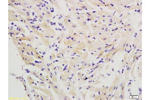 Formalin-fixed and paraffin embedded rat heart labeled with Anti-FLIP Polyclonal Antibody, Unconjugated  at 1:200 followed by conjugation to the secondary antibody and DAB staining.