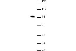 SOX6 antibody (pAb) tested by Western blot.