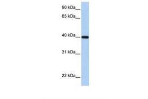 Image no. 1 for anti-Retinol Dehydrogenase 11 (All-Trans/9-Cis/11-Cis) (RDH11) (C-Term) antibody (ABIN6738449) (RDH11 antibody  (C-Term))