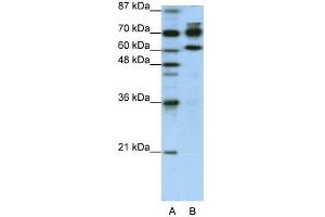 WB Suggested Anti-ADARB1 Antibody Titration:  1. (RED1 antibody  (N-Term))