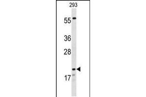 Western blot analysis of CLDN8 Antibody in 293 cell line lysates (35ug/lane) (CLDN8 antibody  (AA 140-166))