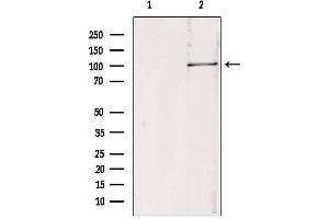 Western blot analysis of extracts from 293, using RBM15 antibody. (RBM15 antibody  (N-Term))