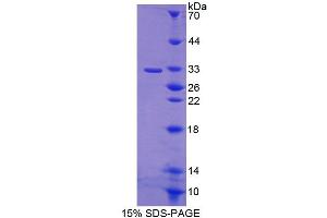Image no. 1 for ATP-Binding Cassette, Sub-Family B (MDR/TAP), Member 9 (ABCB9) (AA 500-762) protein (T7 tag,His tag) (ABIN4989915)