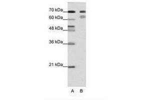 Image no. 1 for anti-Transcription Factor 3 (E2A Immunoglobulin Enhancer Binding Factors E12/E47) (TCF3) (N-Term) antibody (ABIN202854) (TCF3 antibody  (N-Term))