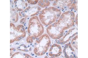 Used in DAB staining on fromalin fixed paraffin- embedded kidney tissue (alpha Adducin antibody  (AA 99-328))