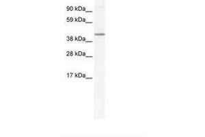 Image no. 1 for anti-Nuclear Receptor Subfamily 1, Group H, Member 5 (NR1H5) (AA 24-73) antibody (ABIN202547) (NR1H5 antibody  (AA 24-73))