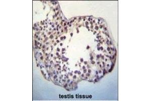 TPTEa Antibody (N-term) (ABIN652246 and ABIN2841038) immunohistochemistry analysis in formalin fixed and paraffin embedded human testis tissue followed by peroxidase conjugation of the secondary antibody and DAB staining. (TPTEa antibody  (N-Term))