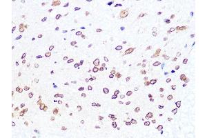 Immunohistochemistry of paraffin-embedded mouse spinal cord using Lamin B2 Rabbit mAb (ABIN1679310, ABIN3019324, ABIN3019325 and ABIN7101750) at dilution of 1:100 (40x lens). (Lamin B2 antibody)