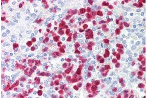 Human Spleen, Neutrophils (formalin-fixed, paraffin-embedded) stained with S100A8 antibody ABIN214203 at 2. (S100A8 antibody)