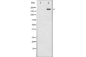 Western blot analysis of Tuberin/TSC2 expression in 293 whole cell lysates,The lane on the left is treated with the antigen-specific peptide. (Tuberin antibody  (Internal Region))