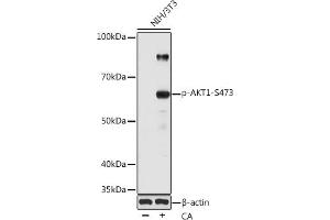 Western blot analysis of extracts of various cell lines, using Phospho--S473 pAb (ABIN1513328, ABIN5664973, ABIN5664975 and ABIN6225474) at 1:1000 dilution. (AKT1 antibody  (pSer473))