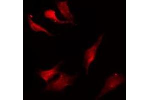 ABIN6275200 staining HepG2 by IF/ICC. (KCNN4 antibody  (C-Term))