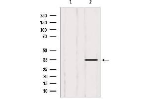 Western blot analysis of extracts from 293, using LDHB antibody.