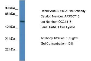 Western Blotting (WB) image for anti-rho GTPase Activating Protein 19 (ARHGAP19) (C-Term) antibody (ABIN2788550)