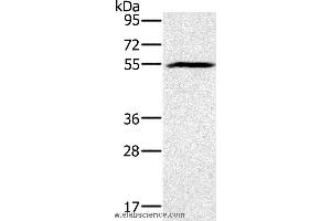 Western blot analysis of Mouse heart tissue, using BMP6 Polyclonal Antibody at dilution of 1:500 (BMP6 antibody)
