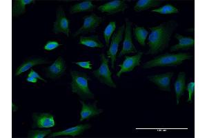 Immunofluorescence of monoclonal antibody to TPR on HeLa cell. (TPR antibody  (AA 1-98))