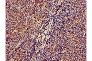Immunohistochemistry of paraffin-embedded human lymph node tissue using ABIN7176612 at dilution of 1:100 (ZKSCAN3 antibody  (AA 8-275))