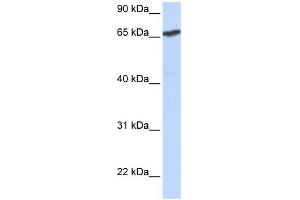 WB Suggested Anti-L3MBTL Antibody Titration:  0. (L3MBTL1 antibody  (N-Term))