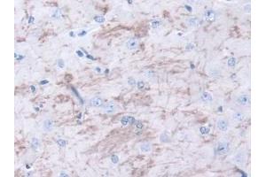 IHC-P analysis of Mouse Cerebrum Tissue, with DAB staining. (METRN antibody  (AA 22-291))