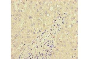 Immunohistochemistry of paraffin-embedded human liver tissue using ABIN7157839 at dilution of 1:100 (Lactoferrin antibody  (AA 156-413))