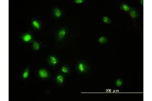Immunofluorescence of monoclonal antibody to STAT5B on HeLa cell. (STAT5B antibody  (AA 1-390))