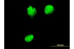Immunofluorescence of monoclonal antibody to NUP62 on HeLa cell.