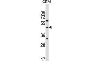Western Blotting (WB) image for anti-Cbl proto-oncogene C (CBLC) antibody (ABIN2996831) (CBLC antibody)