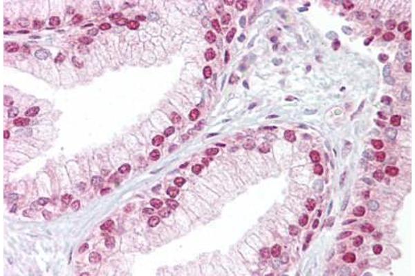 TCEA1 antibody  (AA 71-120)