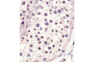 staining MLL3 in human testis tissue sections by Immunohistochemistry (IHC-P - paraformaldehyde-fixed, paraffin-embedded sections). (MLL3 antibody  (C-Term))