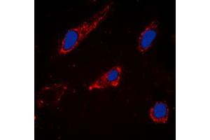 Immunofluorescent analysis of Cytochrome P450 2C19 staining in Hela cells. (CYP2C19 antibody  (Center))