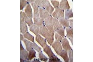 VILL Antibody (Center) immunohistochemistry analysis in formalin fixed and paraffin embedded human skeletal muscle followed by peroxidase conjugation of the secondary antibody and DAB staining. (VILL antibody  (Middle Region))