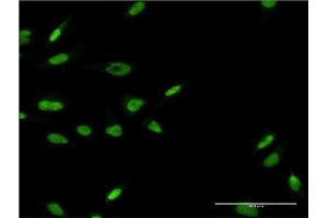 Immunofluorescence of monoclonal antibody to LHX6 on HeLa cell. (LHX6 antibody  (AA 274-363))
