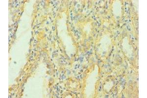 Immunohistochemistry of paraffin-embedded human kidney tissue using ABIN7159700 at dilution of 1:100 (MCPH1 antibody  (AA 536-835))