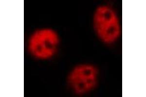 anti-Nuclear Factor of kappa Light Polypeptide Gene Enhancer in B-Cells 1 (NFKB1) (pSer927) antibody